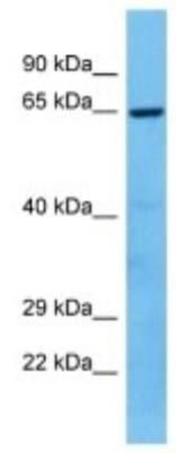 TMEM87A Rabbit anti-Mouse, Polyclonal, Novus Biologicals 100 &mu;g; Unconjugated:Antibodies,